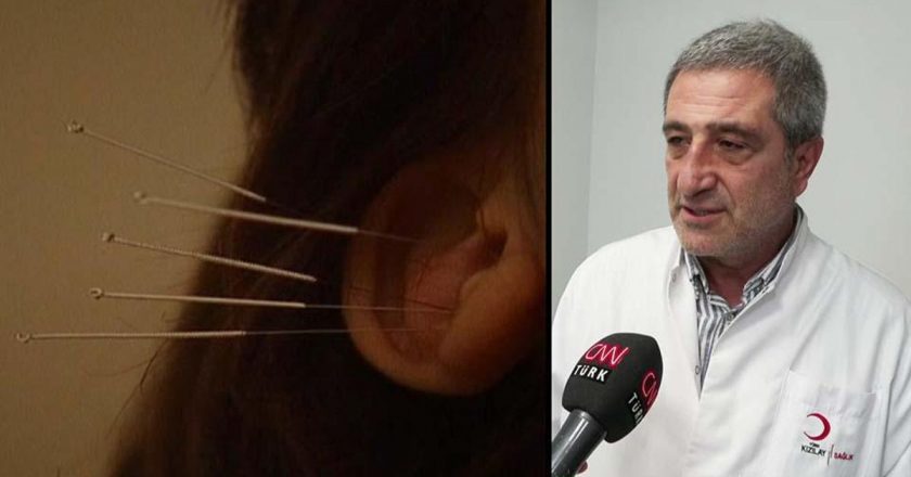 Akupunktur tedavisi nasıl uygulanır?