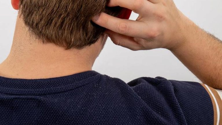 Metal aksesuarlarına ve tekstil boyasına dikkat edin: Egzamanın gizli tetikleyicileri