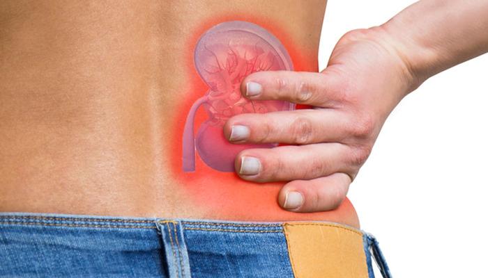 Böbrek taşı sadece yetişkinlerin sorunu değil: Her yaşta görülebilir! Uzmanlar risklere karşı uyardı…